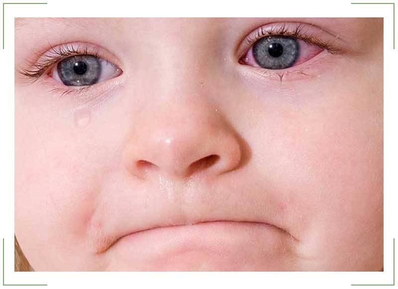 Аденовирусная инфекция у детей: симптомы и лечение, диагностика, осложнения