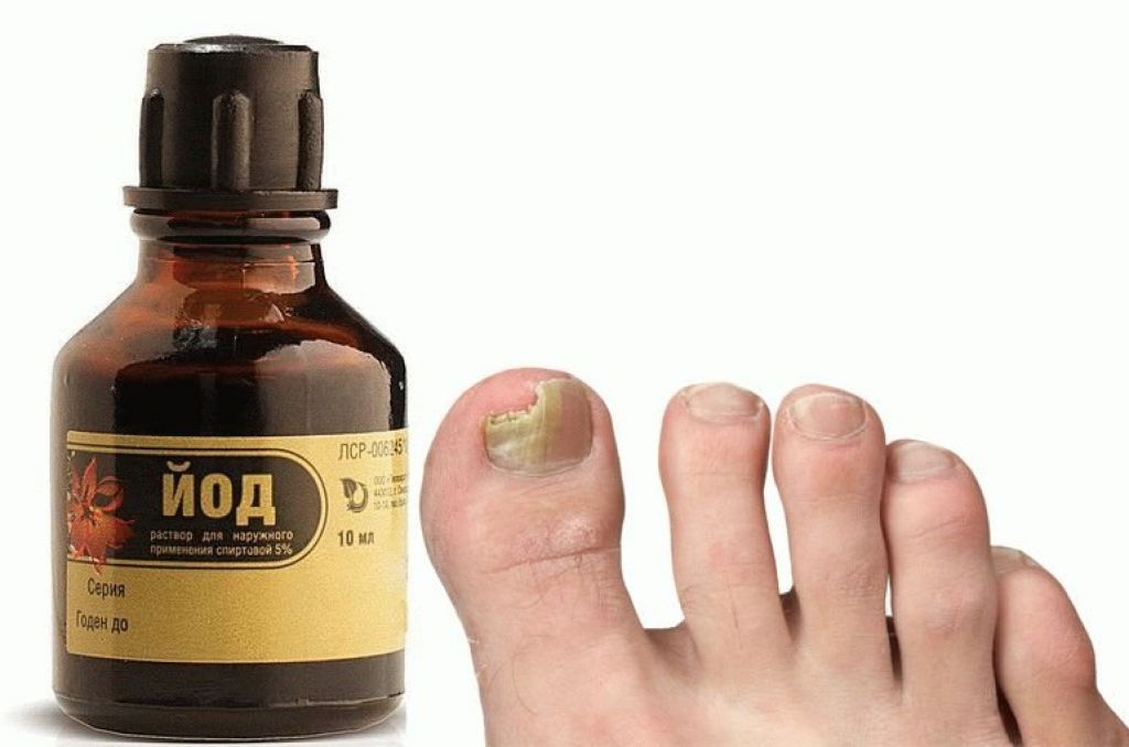 Чистотел против грибка ногтей на ногах: лечение соком и маслом | ogribke.ru