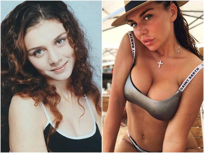 Анна седакова: фото до и после пластики