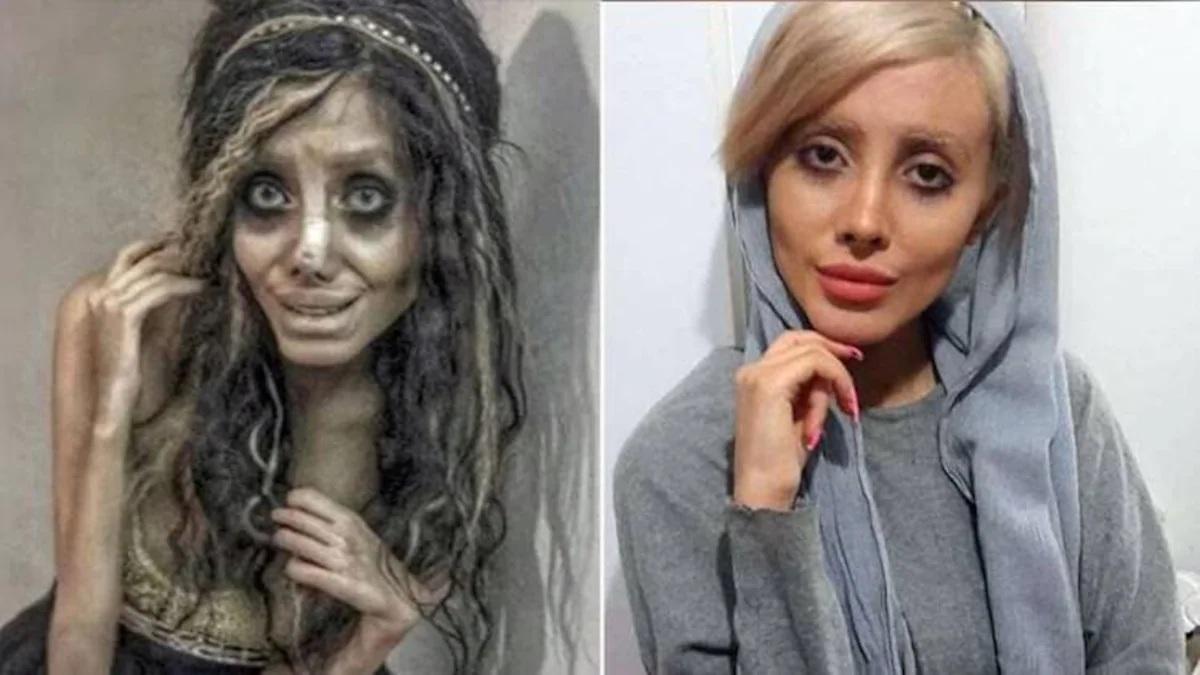 Иранская "анджелина джоли" изменилась и превратилась в красавицу: как выглядит сейчас (фото до и после)
