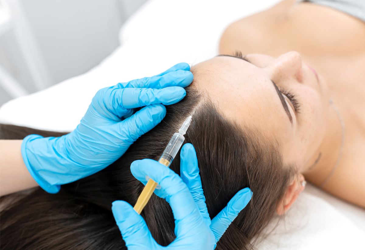 Плазмолифтинг волосистой части головы: подготовка, показания | food and health