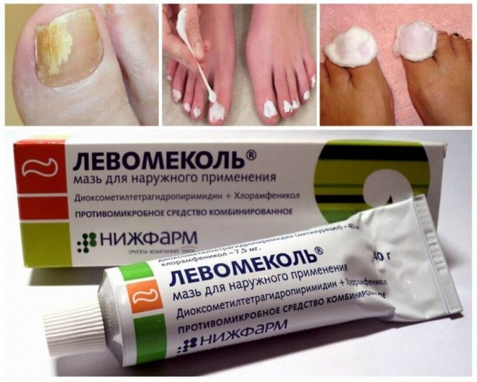 Топ-10 лучших мазей от грибка ногтей на ногах: список эффективных и недорогих препаратов
