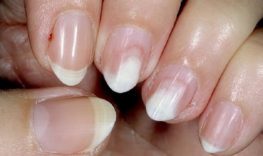 Почему отслаиваются нарощенные ногти? – все о красоте и не только