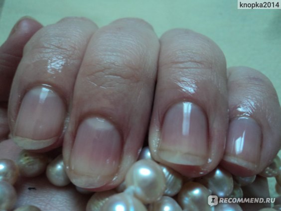 Вреден ли шеллак для ногтей: как восстановить ногти после гель-лака