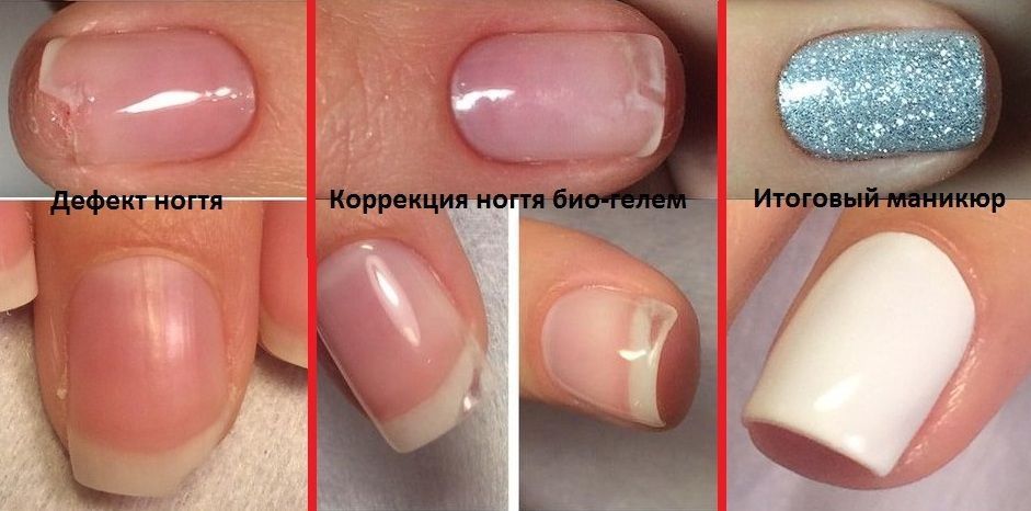 Биогель для ногтей – что это, как пользоваться, фото до и после