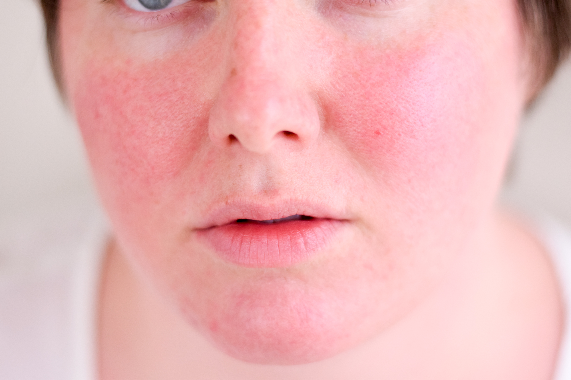 Как состояние желудочно-кишечного тракта влияет на состояние кожи | стимбифид плюс