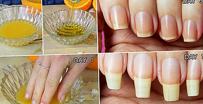 Как ускорить рост ногтей: маски, ванночки и косметика