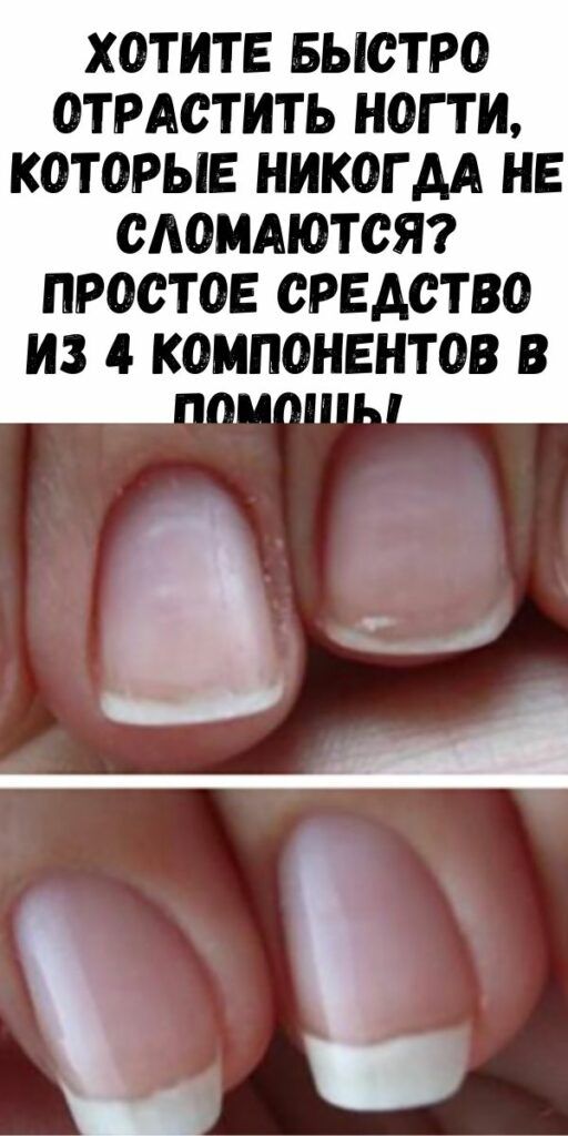 Как быстро отрастить ногти — modnail.ru — красивый маникюр