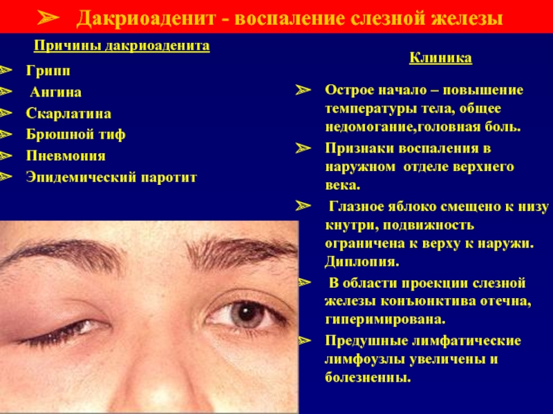 Ушиб глазного яблока - симптомы болезни, профилактика и лечение ушиба глазного яблока, причины заболевания и его диагностика на eurolab