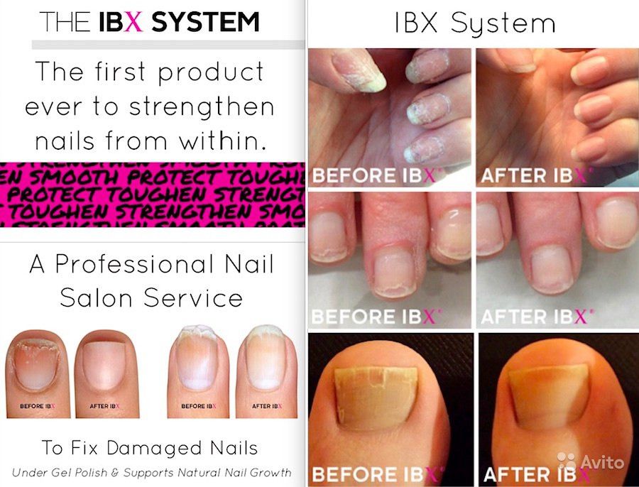 Лечебное покрытие для ногтей ibx что это такое