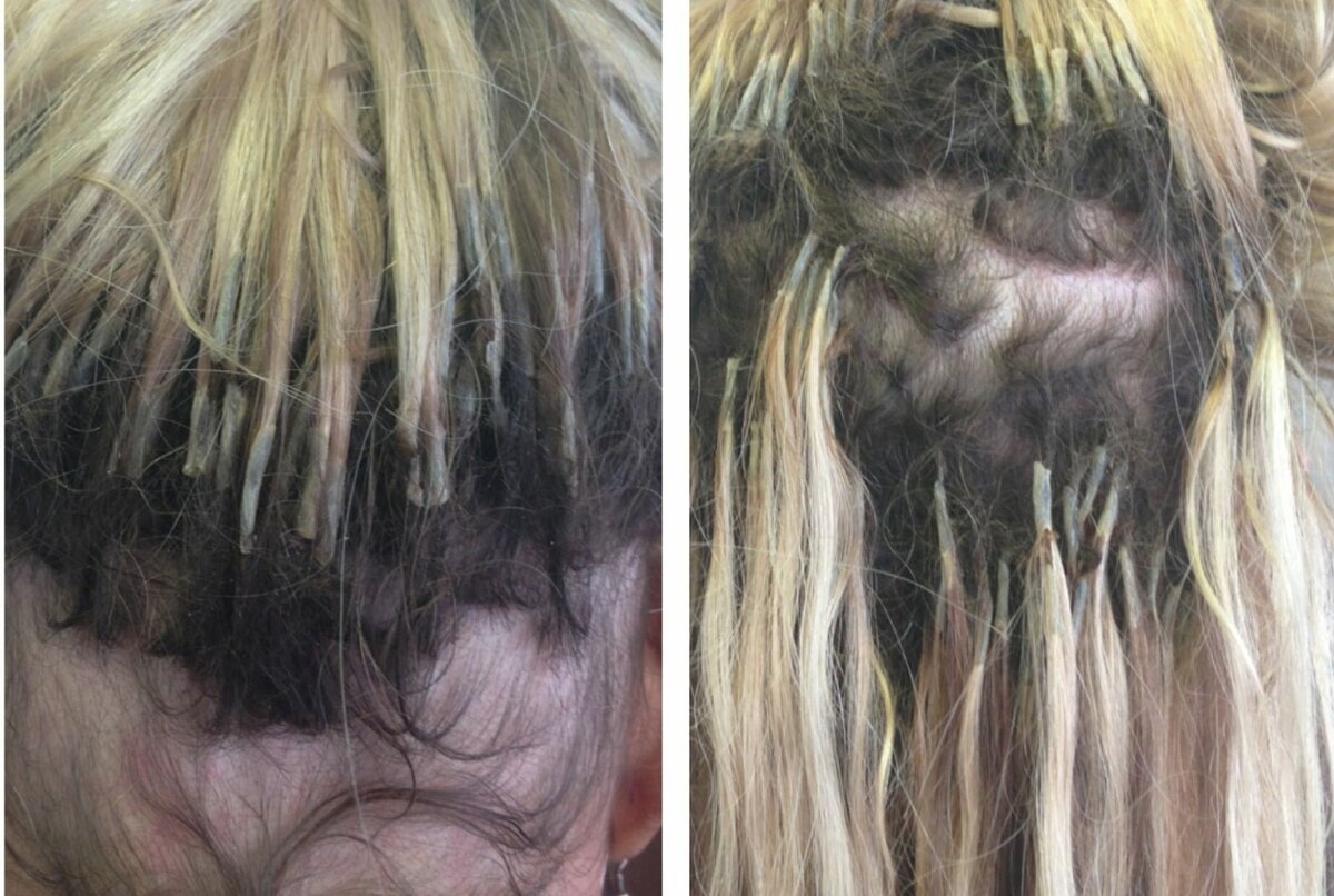 2022 (+54 фото) как выглядят волосы после снятия нарощенных волос