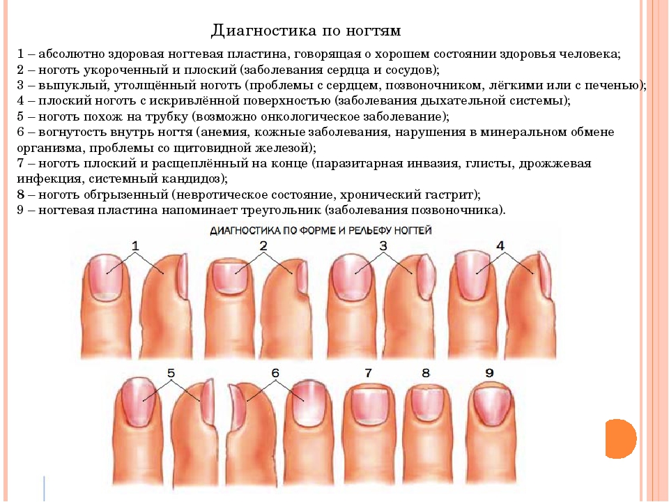 Изменение толщины ногтя