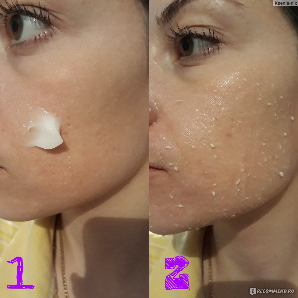 Очищение кожи лица: этапы и правила безопасного очищения