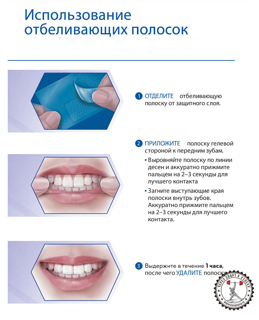 Отбеливающие полоски для зубов: применение, плюсы и минусы