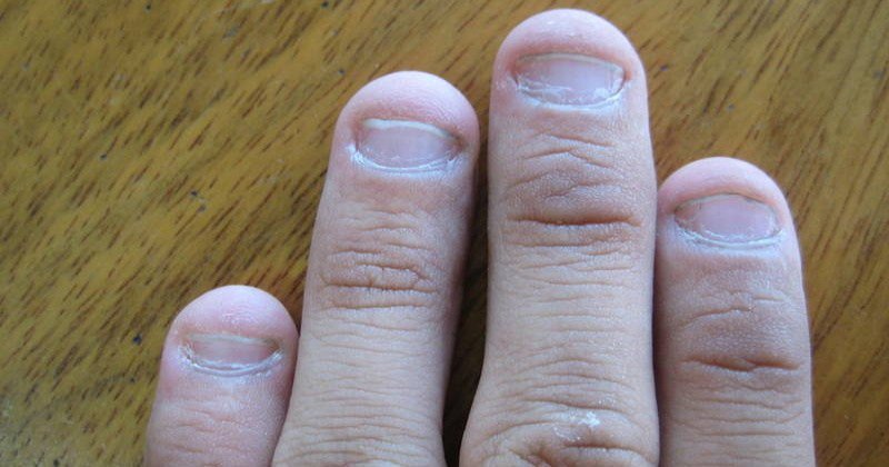 Боремся с собой: как отучиться грызть ногти на руках?