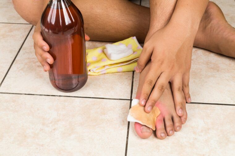 Лечение грибка ногтей уксусом в домашних условиях: самые быстрые способы