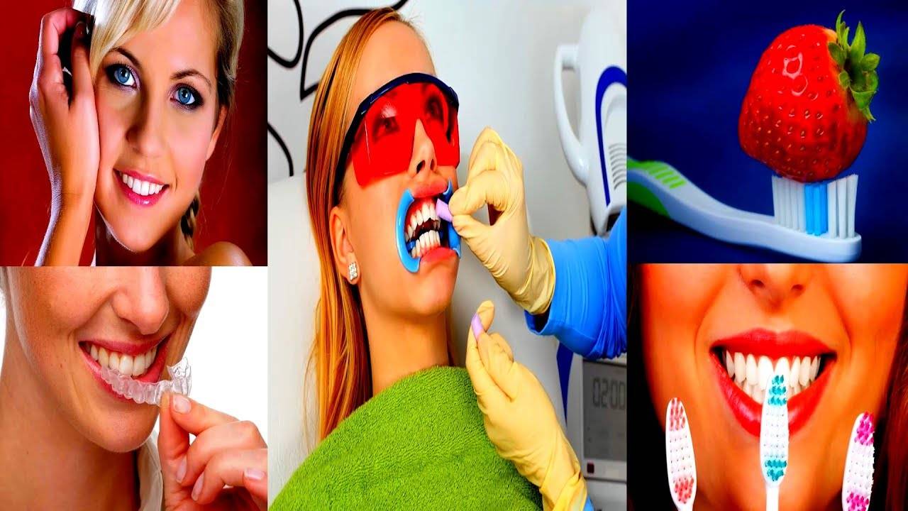 Рецепт отбеливания зубов. Отбеливание зубов. Отбеливание зубов народными средствами. Народные методы отбеливания зубов. Мощное отбеливание зубов.