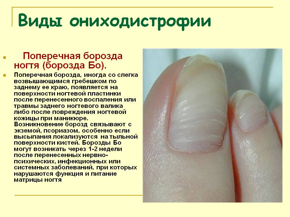 Изменение толщины ногтя | центр подологии и остеопатии татьяны красюк