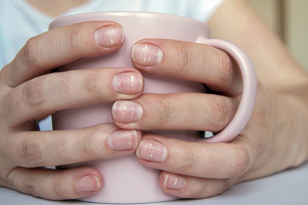 Что означают белые пятна на ногтях рук с точки зрения медиков