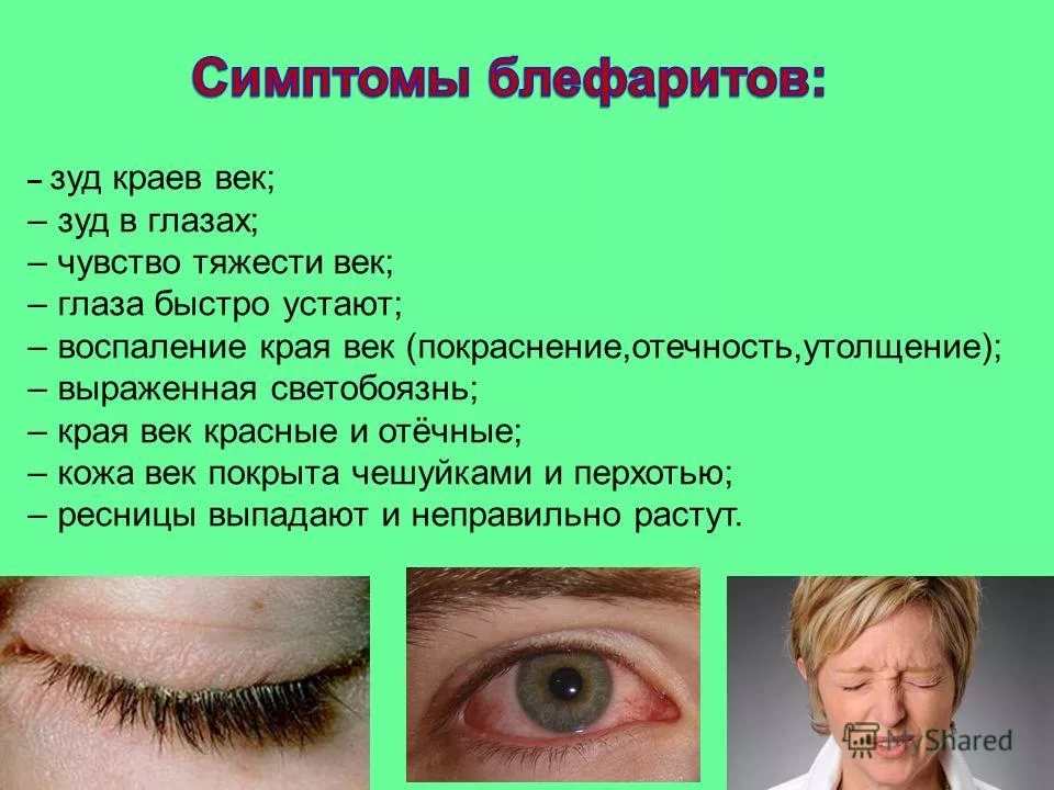 Зуд и покраснение вокруг глаз