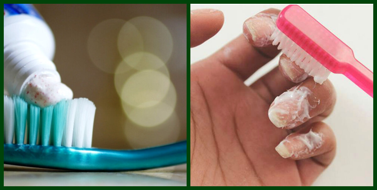 Как правильно очистить ногти от грязи после домашней или садовой работы?