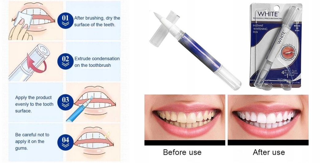 Белые зубы: эффективные и безопасные способы отбеливания, советы для белоснежной улыбки