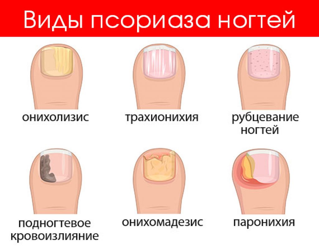 Ногти как индикатор здоровьяforpost - здоровье |