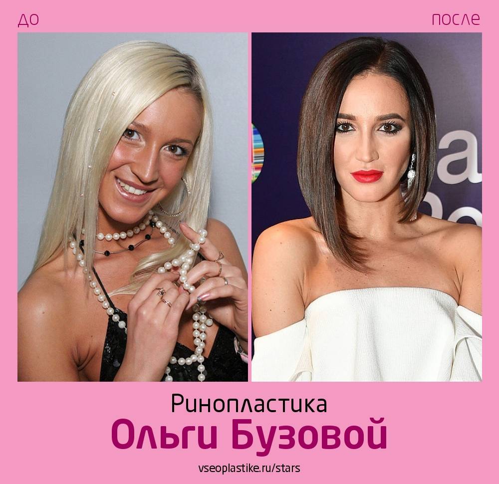 Ольга бузова до и после пластики – фото и биография