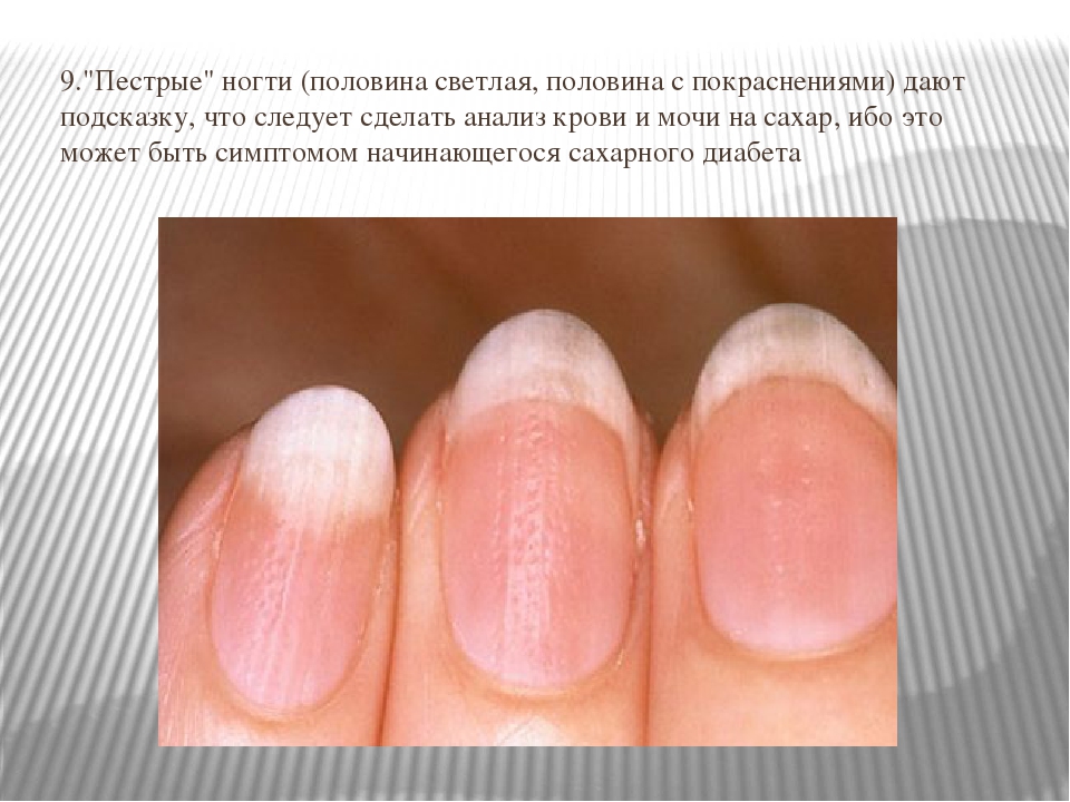 Лунки в ногтях: значение в хиромантии