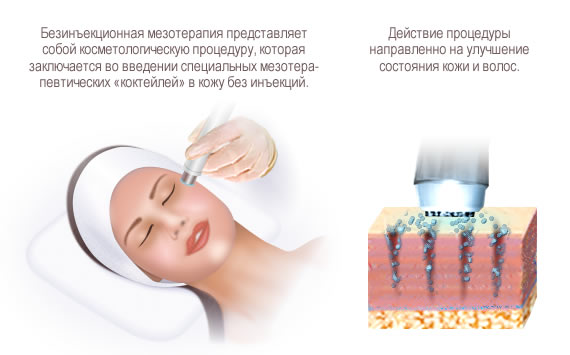 Аппаратная косметология: безинъекционная биоревитализация