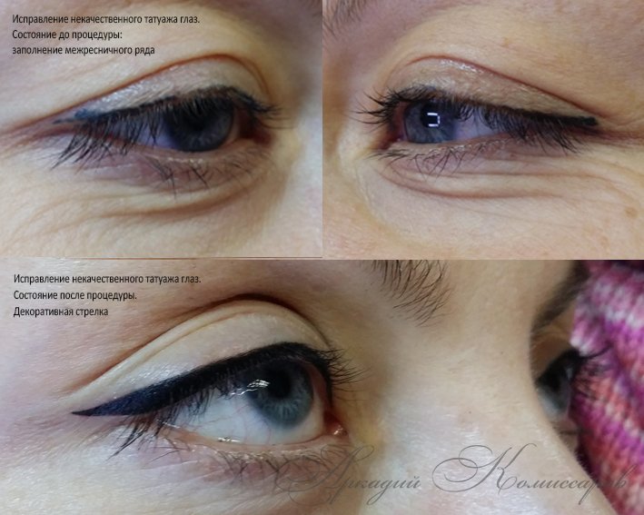 Татуаж глаз: всё, что нужно знать перед процедурой перманетного макияжа + 10 полезных советов о татуаже глаз