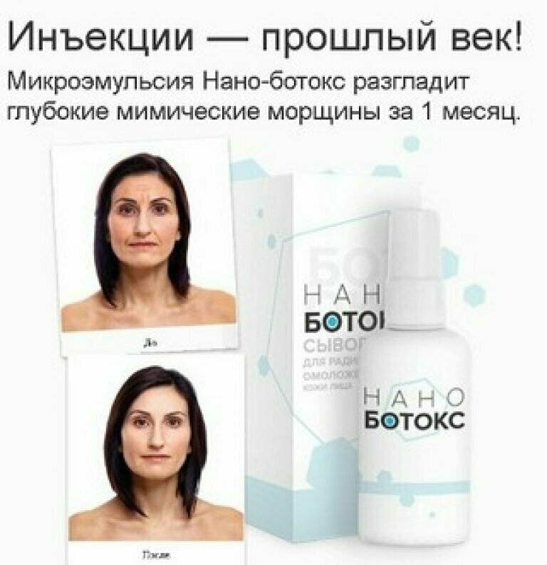 Ботулинотерапия в косметологии – что это такое: препараты, показания, рекомендации и осложнения