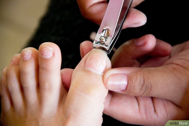 Как правильно подстричь ногти на ногах на большом пальце