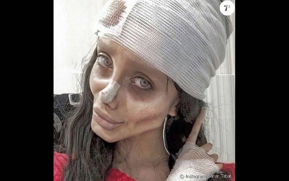 Сахар табар- пластические операции иранской девушки-зомби