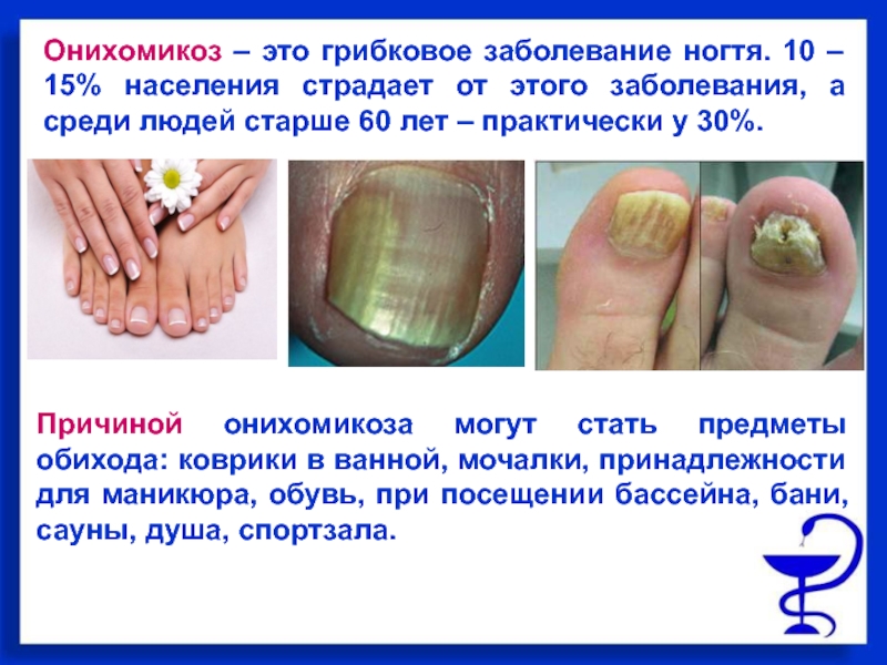 Какие заболевания могут влиять на внешний вид ногтей • журнал nails