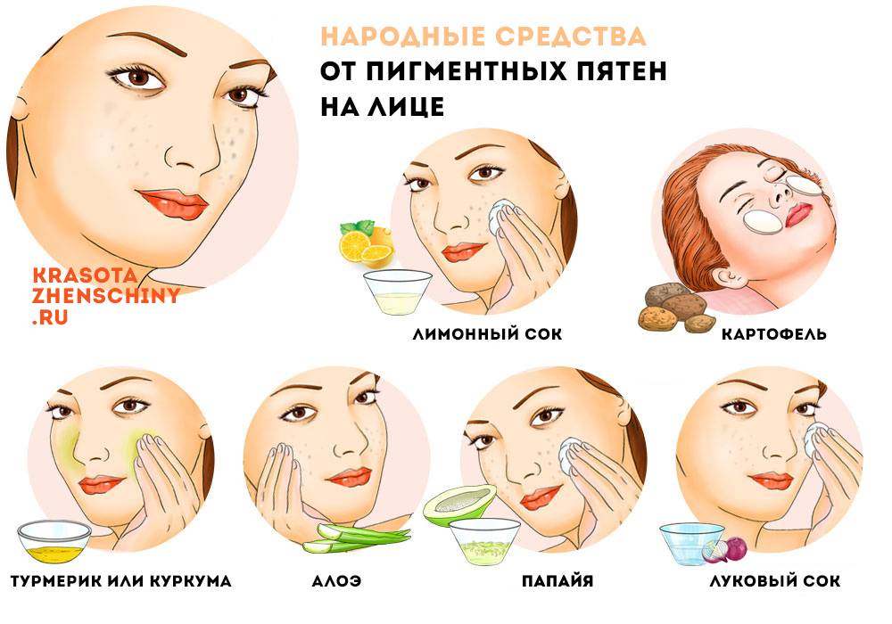 Как удалить пигментные пятна на лице