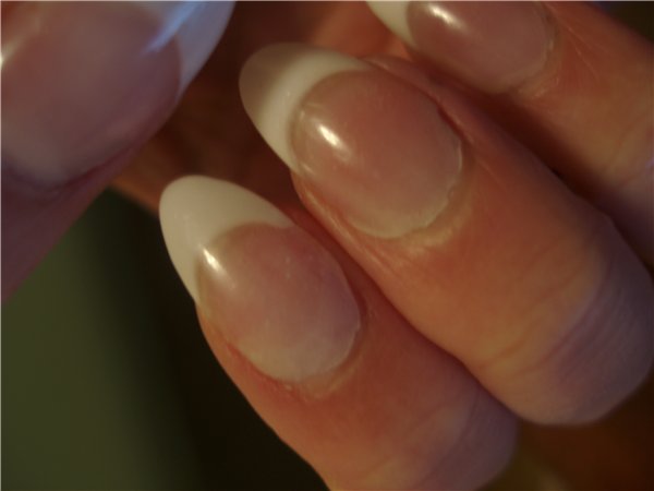 Причины отслоения наращенных гелем ногтей