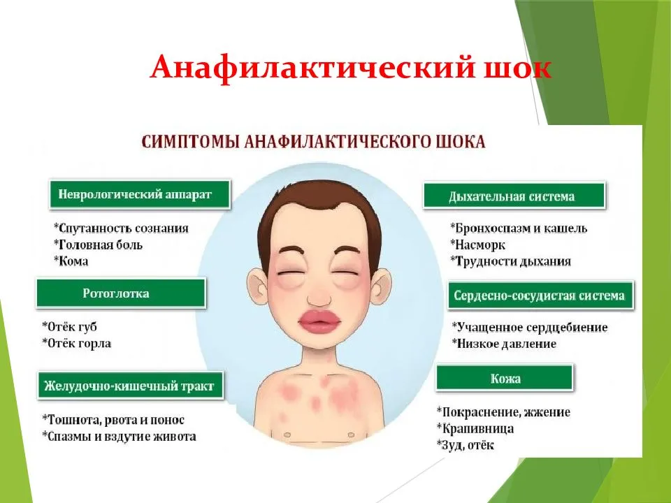 Аллергия на лице: симптомы, причины и лечение