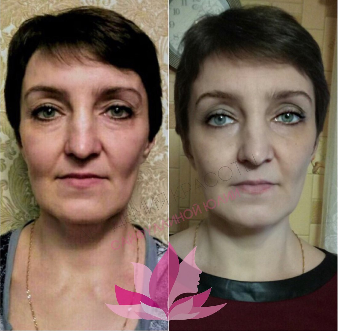 Массаж лица для подтяжки фото до и после