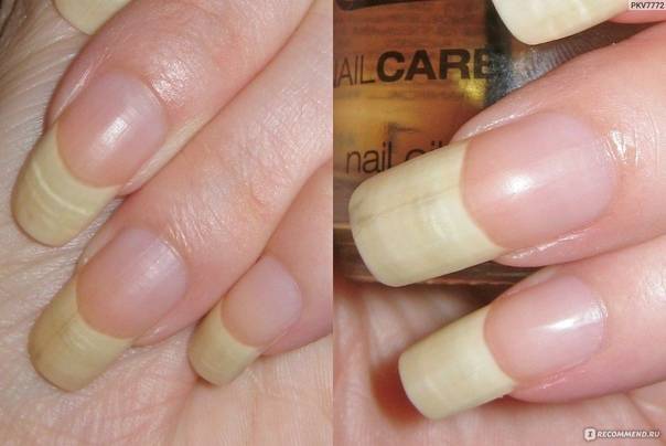 Как стереть лак для ногтей: 13 самых эффективных методов удаления
