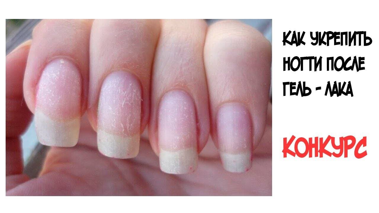 Как восстановить ногти после гель лака, как укрепить ногти после шеллака, как лечить, если болят ногти