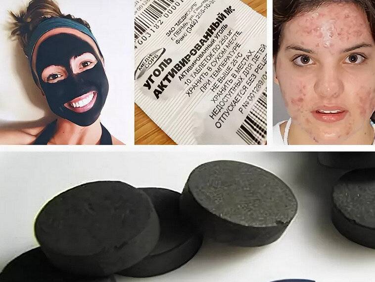 Маски из активированного угля для лица: как применять, рецепты
топ 10 масок для лица с активированным углем — modnayadama