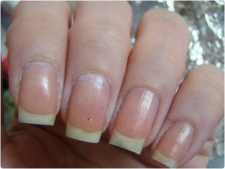 Восстанавливаем ногти после наращивания и гель-лака