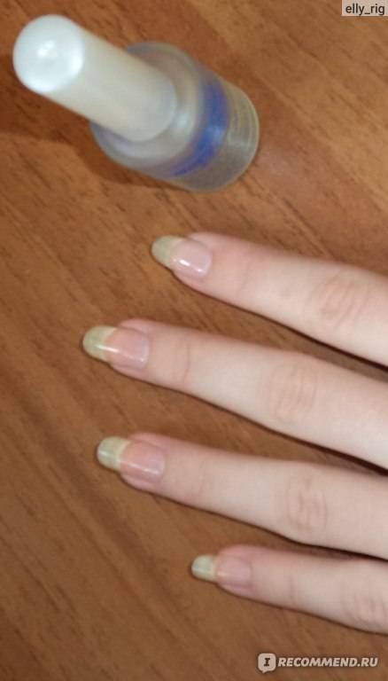 Как отрастить длинные ногти в домашних условиях, причины ломкости