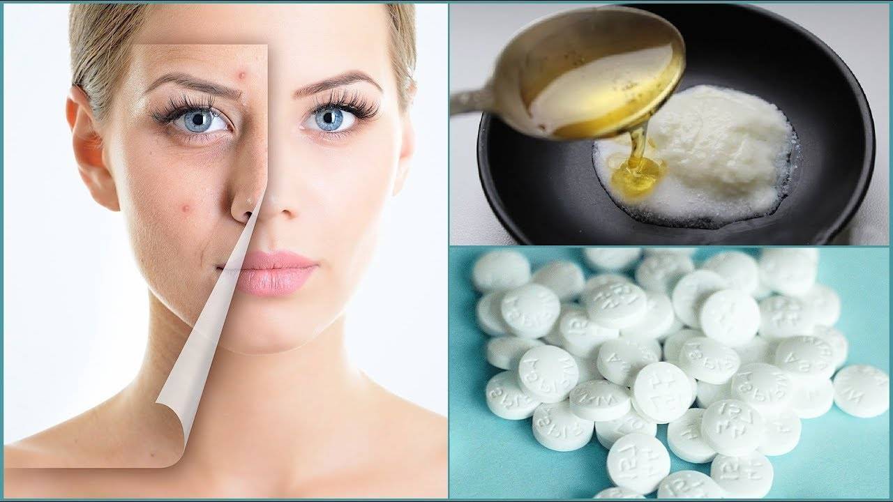 Маски с аспирином для кожи лица: от угрей, прыщей и морщин - 15 лучших рецептов - женский угодник