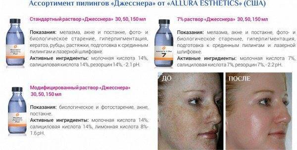 Пилинг джесснера — голливудский уход за кожей лица
