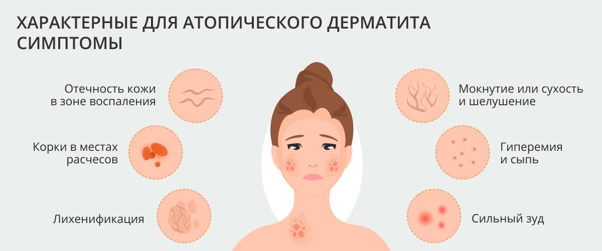 Стрептодермия | симптомы | диагностика | лечение - docdoc.ru