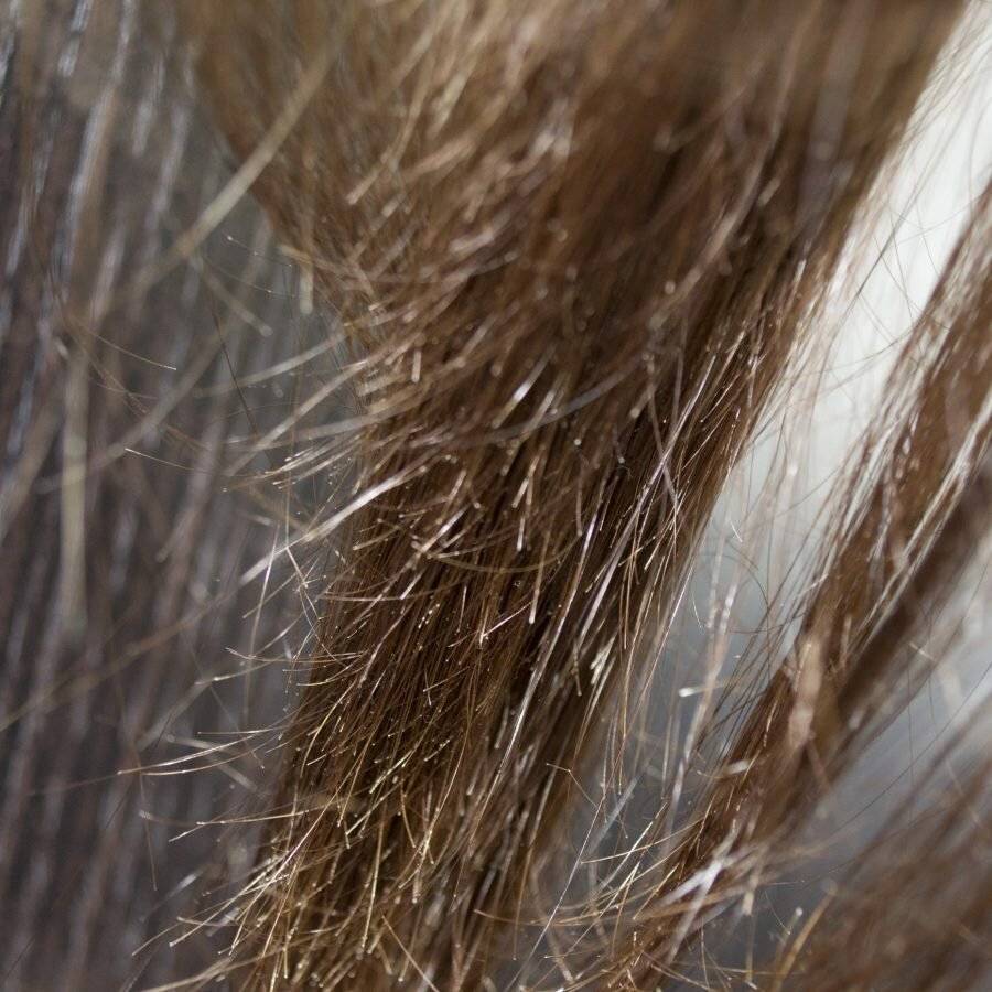 Секущиеся волосы. методы борьбы | блог expert clinics