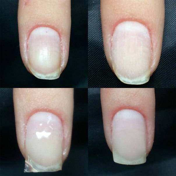 Как восстановить ногти после гель лака — отзывы