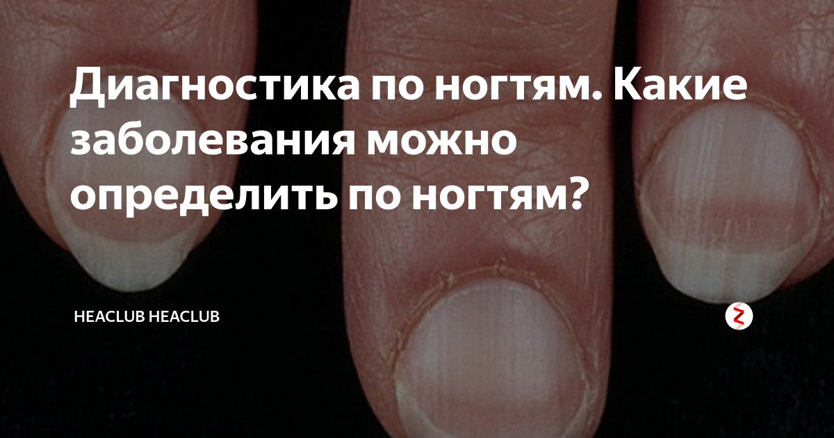 Лечение болезней и повреждений ногтей и кутикулы. о чём говорят деформации, ломкость и изменение цвета ногтей - медицинский центр «эхинацея»